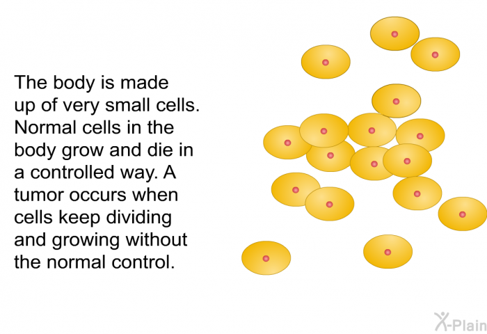 The body is made up of very small cells. Normal cells in the body grow and die in a controlled way. A tumor occurs when cells keep dividing and growing without the normal control.