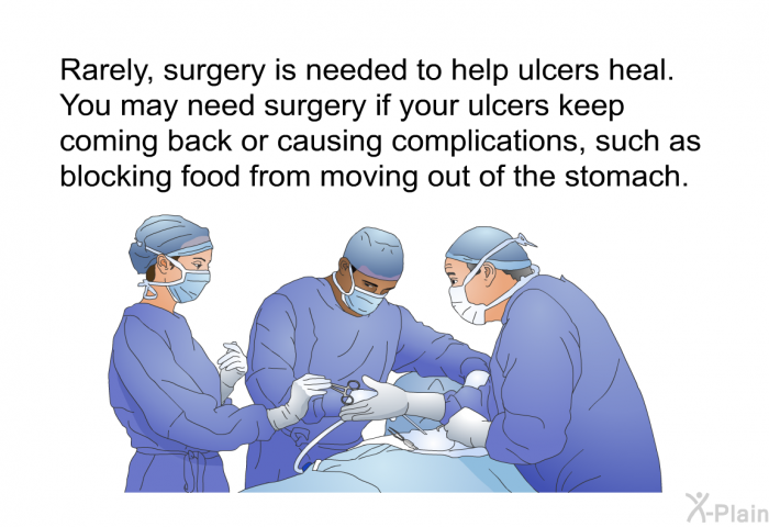 Rarely, surgery is needed to help ulcers heal. You may need surgery if your ulcers keep coming back or causing complications, such as blocking food from moving out of the stomach.