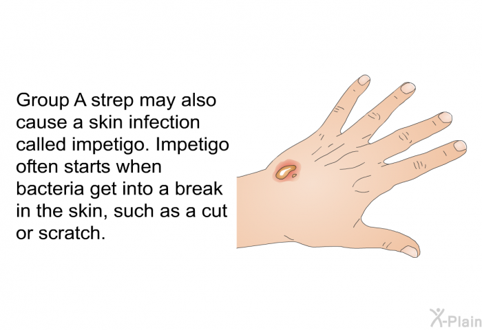 Group A strep may also cause a skin infection called impetigo. Impetigo often starts when bacteria get into a break in the skin, such as a cut or scratch.