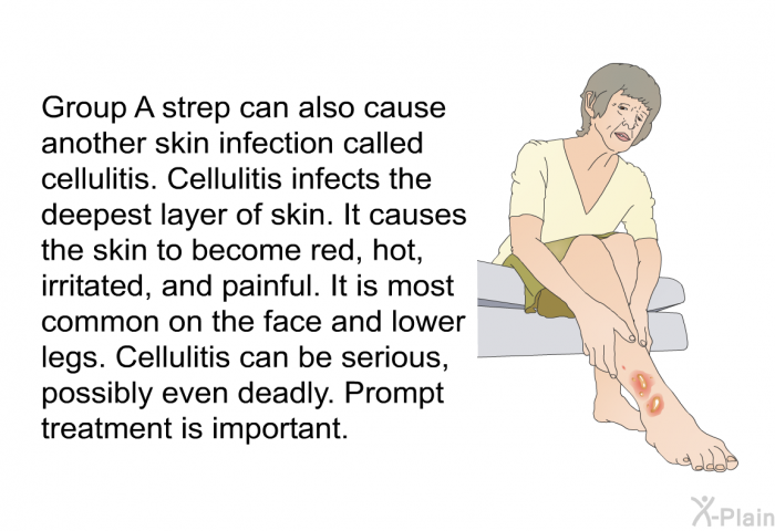 Group A strep can also cause another skin infection called cellulitis. Cellulitis infects the deepest layer of skin. It causes the skin to become red, hot, irritated, and painful. It is most common on the face and lower legs. Cellulitis can be serious, possibly even deadly. Prompt treatment is important.