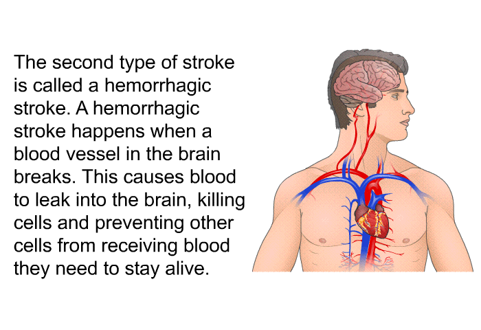The second type of stroke is called a hemorrhagic stroke. A hemorrhagic stroke happens when a blood vessel in the brain breaks. This causes blood to leak into the brain, killing cells and preventing other cells from receiving blood they need to stay alive.
