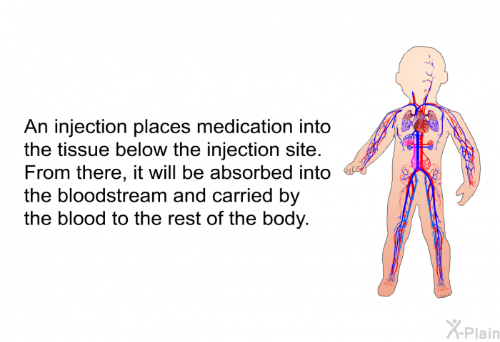 An injection places medication into the tissue below the injection site. From there, it will be absorbed into the bloodstream and carried by the blood to the rest of the body.