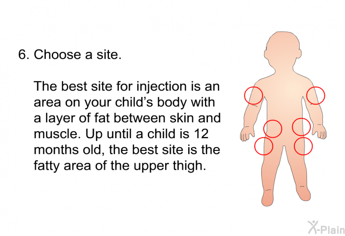 Choose a site
The best site for injection is an­ area on your child’s body with a layer of fat between skin and muscle. Up until a child is 12 months old, the best site is the fatty area of the upper thigh.
