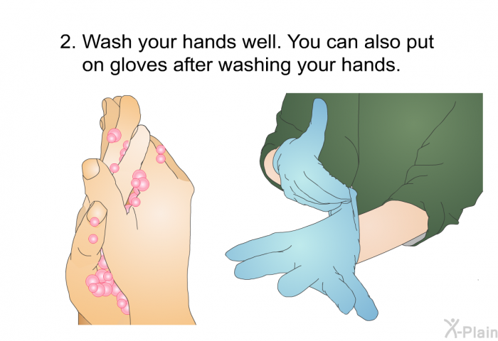 Wash your hands well. You can also put on gloves after washing your hands.