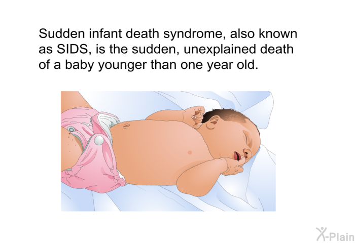 Sudden infant death syndrome, also known as SIDS, is the sudden, unexplained death of a baby younger than one year old.