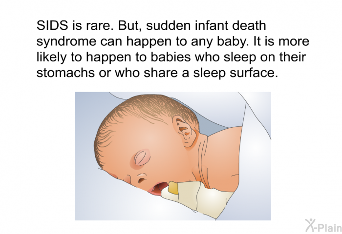 SIDS is rare. But, sudden infant death syndrome can happen to any baby. It is more likely to happen to babies who sleep on their stomachs or who share a sleep surface.