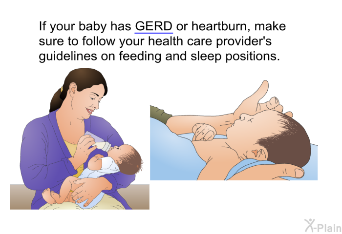 If your baby has GERD or heartburn, make sure to follow your health care provider's guidelines on feeding and sleep positions.