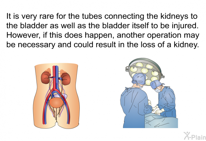 It is very rare for the tubes connecting the kidneys to the bladder as well as the bladder itself to be injured. However, if this does happen, another operation may be necessary and could result in the loss of a kidney.