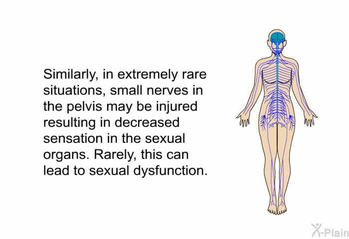 Similarly, in extremely rare situations, small nerves in the pelvis may be injured resulting in decreased sensation in the sexual organs. Rarely, this can lead to sexual dysfunction.