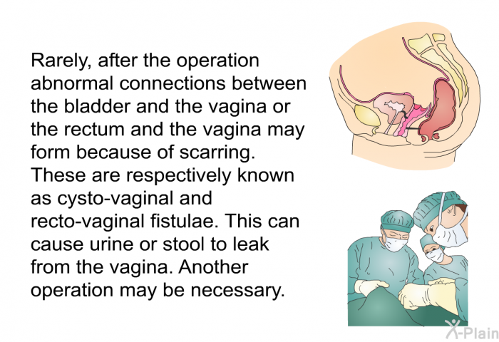 Rarely, after the operation abnormal connections between the bladder and the vagina or the rectum and the vagina may form because of scarring. These are respectively known as cysto-vaginal and recto-vaginal fistulae. This can cause urine or stool to leak from the vagina. Another operation may be necessary.