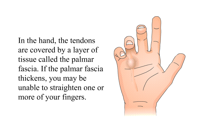 In the hand, the tendons are covered by a layer of tissue called the palmar fascia. If the palmar fascia thickens, you may be unable to straighten one or more of your fingers.