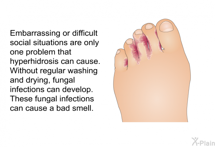 Embarrassing or difficult social situations are only one problem that hyperhidrosis can cause. Without regular washing and drying, fungal infections can develop. These fungal infections can cause a bad smell.