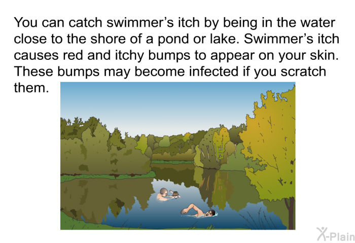 You can catch swimmer's itch by being in the water close to the shore of a pond or lake. Swimmer's itch causes red and itchy bumps to appear on your skin. These bumps may become infected if you scratch them.