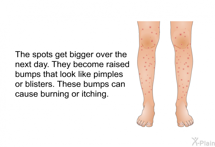 The spots get bigger over the next day. They become raised bumps that look like pimples or blisters. These bumps can cause burning or itching.