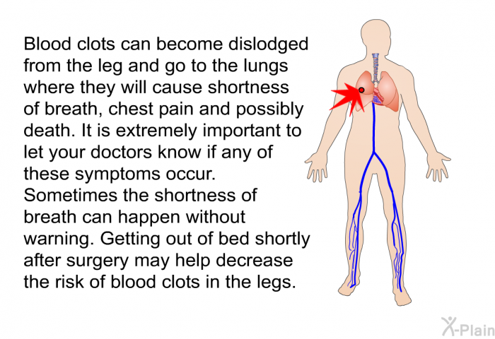 Blood clots can become dislodged from the leg and go to the lungs where they will cause shortness of breath, chest pain and possibly death. It is extremely important to let your doctors know if any of these symptoms occur. Sometimes the shortness of breath can happen without warning. Getting out of bed shortly after surgery may help decrease the risk of blood clots in the legs.