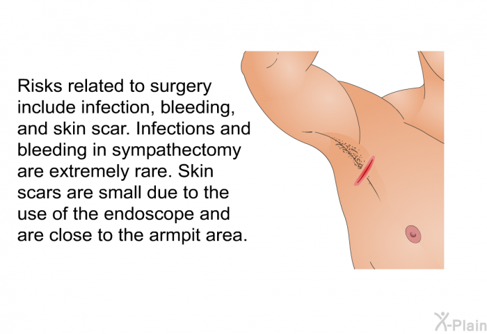 Risks related to surgery include infection, bleeding, and skin scar. Infections and bleeding in sympathectomy are extremely rare. Skin scars are small due to the use of the endoscope and are close to the armpit area.