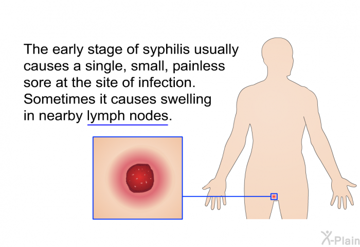 The early stage of syphilis usually causes a single, small, painless sore at the site of infection. Sometimes it causes swelling in nearby lymph nodes.