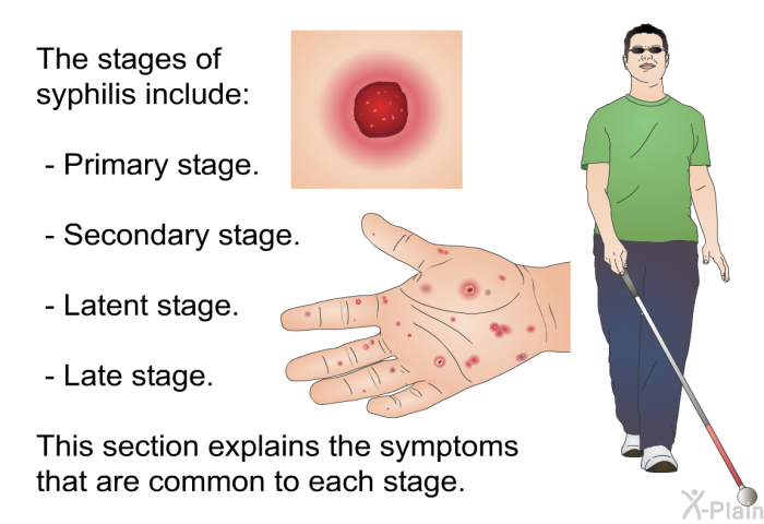 The stages of syphilis include:  Primary stage. Secondary stage. Latent stage. Late stage.  
This section explains the symptoms that are common to each stage.