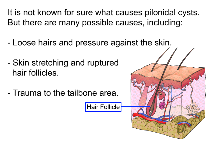 It is not known for sure what causes pilonidal cysts. But there are many possible causes, including:  Loose hairs and pressure against the skin. Skin stretching and ruptured hair follicles. Trauma to the tailbone area.