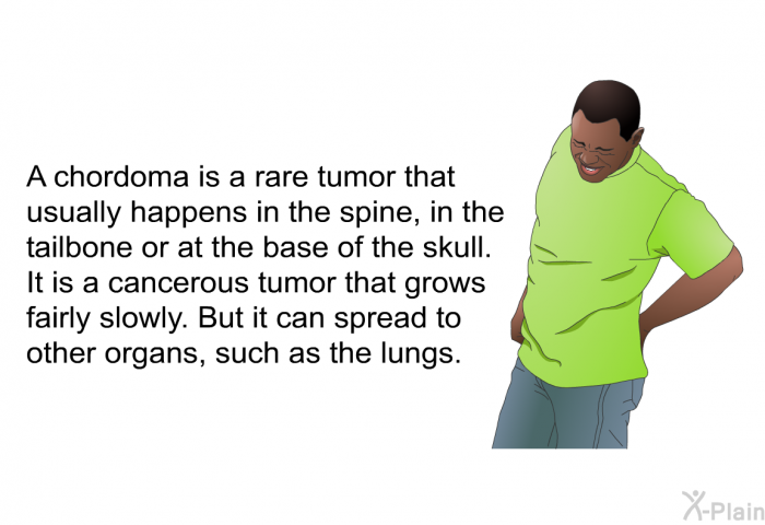 A chordoma is a rare tumor that usually happens in the spine, in the tailbone or at the base of the skull. It is a cancerous tumor that grows fairly slowly. But it can spread to other organs, such as the lungs.