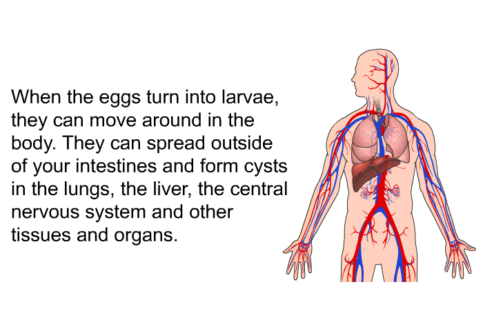 When the eggs turn into larvae, they can move around in the body. They can spread outside of your intestines and form cysts in the lungs, the liver, the central nervous system and other tissues and organs.