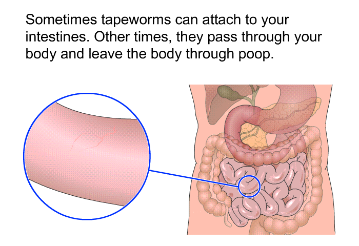 Sometimes tapeworms can attach to your intestines. Other times, they pass through your body and leave the body through poop.