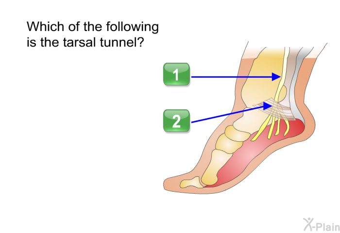 Which of the following is the tarsal tunnel? Select 1 or 2