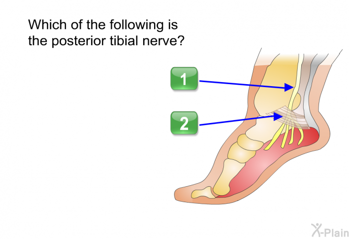 Which of the following is the posterior tibial nerve? Select 1 or 2