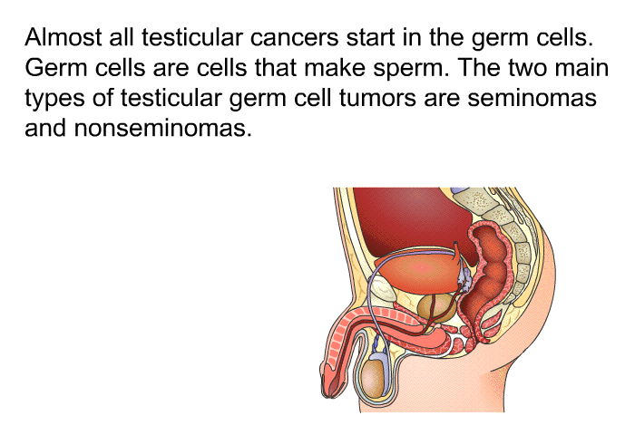 Almost all testicular cancers start in the germ cells. Germ cells are cells that make sperm. The two main types of testicular germ cell tumors are seminomas and nonseminomas.