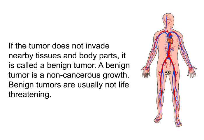 If the tumor does not invade nearby tissues and body parts, it is called a benign tumor. A benign tumor is a non-cancerous growth. Benign tumors are usually not life threatening.