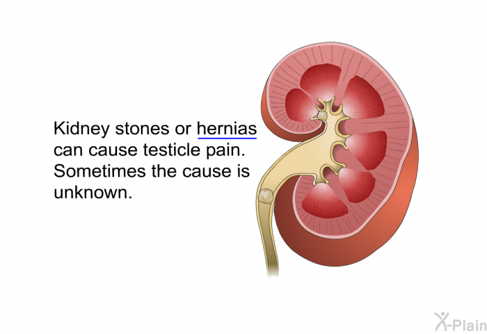 Kidney stones or hernias can cause testicle pain. Sometimes the cause is unknown.