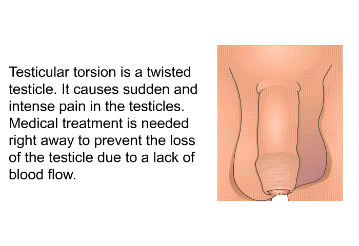 Testicular torsion is a twisted testicle. It causes sudden and intense pain in the testicles. Medical treatment is needed right away to prevent the loss of the testicle due to a lack of blood flow.
