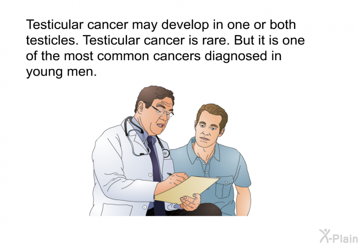 Testicular cancer may develop in one or both testicles. Testicular cancer is rare. But it is one of the most common cancers diagnosed in young men.