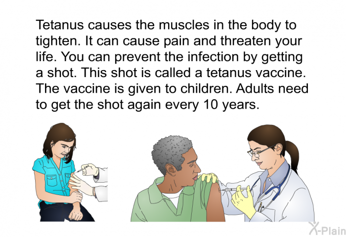 Tetanus causes the muscles in the body to tighten. It can cause pain and threaten your life. You can prevent the infection by getting a shot. This shot is called a tetanus vaccine. The vaccine is given to children. Adults need to get the shot again every 10 years.