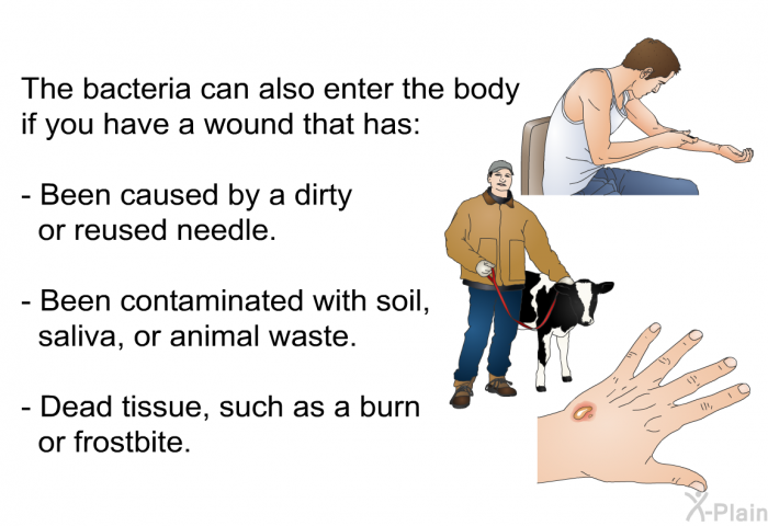 The bacteria can also enter the body if you have a wound that has:  Been caused by a dirty or reused needle. Been contaminated with soil, saliva, or animal waste. Dead tissue, such as a burn or frostbite.