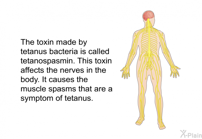 The toxin made by tetanus bacteria is called tetanospasmin. This toxin affects the nerves in the body. It causes the muscle spasms that are a symptom of tetanus.