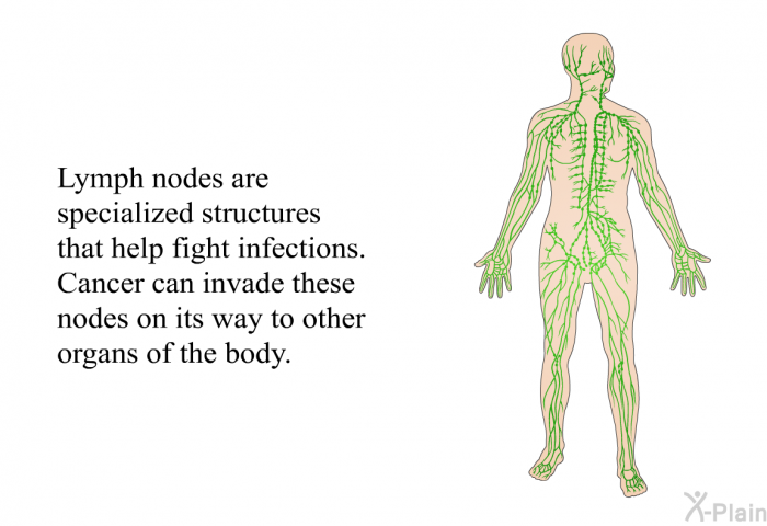 Lymph nodes are specialized structures that help fight infections. Cancer can invade these nodes on its way to other organs of the body.