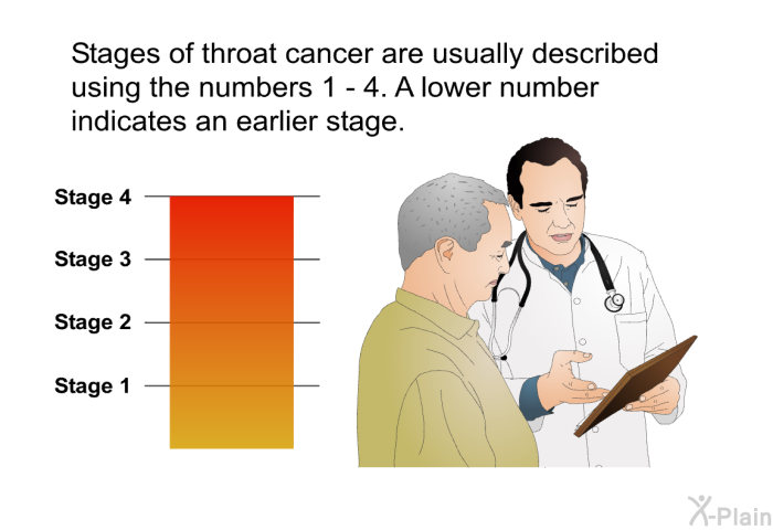 Stages of throat cancer are usually described using the numbers 1 - 4. A lower number indicates an earlier stage.