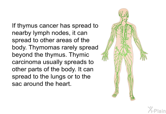 If thymus cancer has spread to nearby lymph nodes, it can spread to other areas of the body. Thymomas rarely spread beyond the thymus. Thymic carcinoma usually spreads to other parts of the body. It can spread to the lungs or to the sac around the heart.