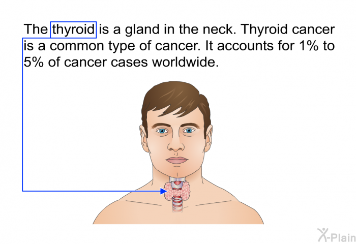 The thyroid is a gland in the neck. Thyroid cancer is a common type of cancer. It accounts for 1% to 5% of cancer cases worldwide.