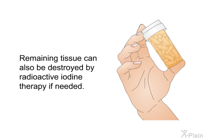 Remaining tissue can also be destroyed by radioactive iodine therapy if needed.