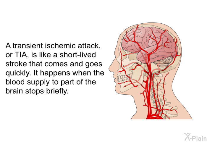 A transient ischemic attack, or TIA, is like a short-lived stroke that comes and goes quickly. It happens when the blood supply to part of the brain stops briefly.