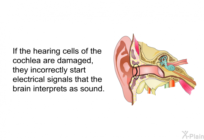 If the hearing cells of the cochlea are damaged, they incorrectly start electrical signals that the brain interprets as sound.