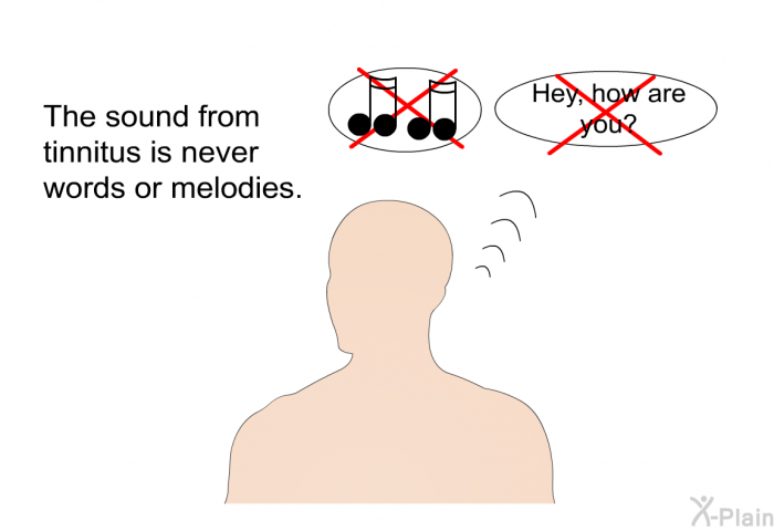 The sound from tinnitus is never words or melodies.