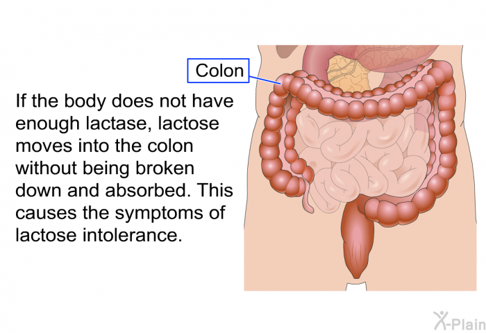 If the body does not have enough lactase, lactose moves into the colon without being broken down and absorbed. This causes the symptoms of lactose intolerance.