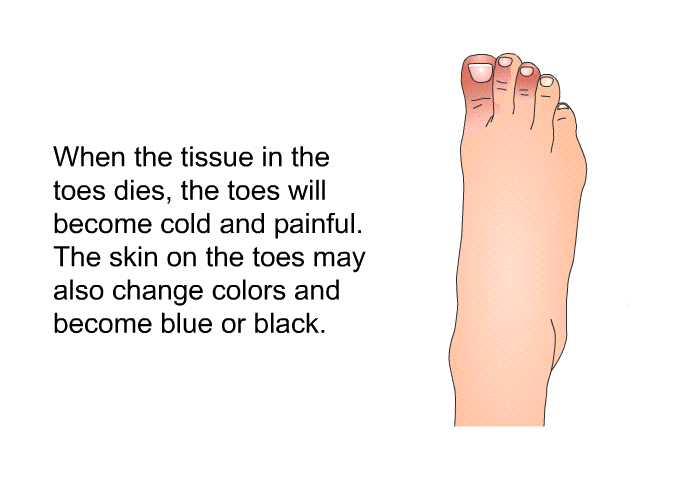 When the tissue in the toes dies, the toes will become cold and painful. The skin on the toes may also change colors and become blue or black.