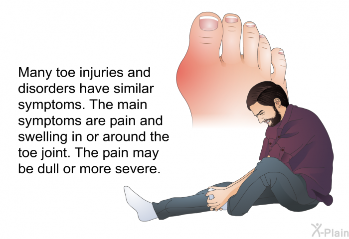 Many toe injuries and disorders have similar symptoms. The main symptoms are pain and swelling in or around the toe joint. The pain may be dull or more severe.