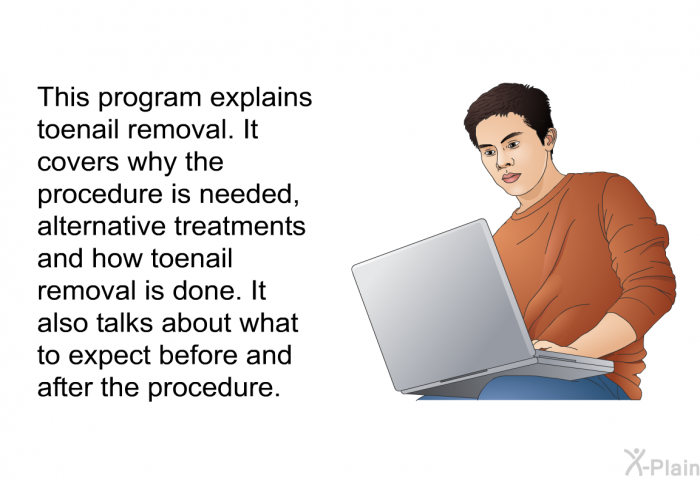 This health information explains toenail removal. It covers why the procedure is needed, alternative treatments and how toenail removal is done. It also talks about what to expect before and after the procedure.