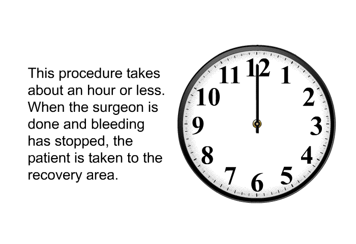 This procedure takes about an hour or less. When the surgeon is done and bleeding has stopped, the patient is taken to the recovery area.