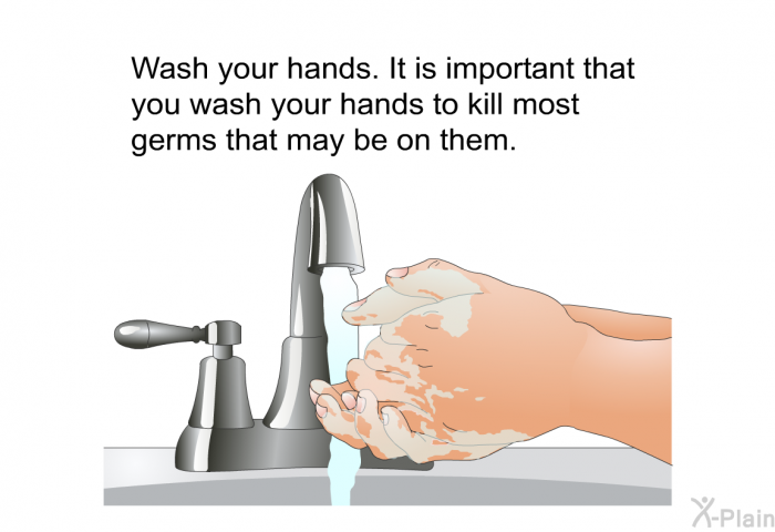 Wash your hands. It is important that you wash your hands to kill most germs that may be on them.